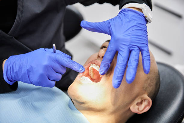 Best Emergency Gum Treatment in Columbia, TN
