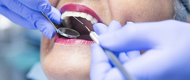 Best Emergency Treatment for Dental Infections or Abscesses in Columbia, TN